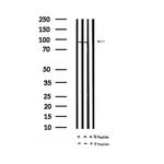 Phospho-LGR5 (Thr842) Antibody in Western Blot (WB)