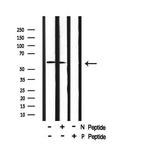 Phospho-BACE1 (Ser498) Antibody in Western Blot (WB)