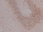 Phospho-CtIP (Ser327) Antibody in Immunohistochemistry (Paraffin) (IHC (P))