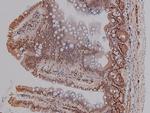 Phospho-CtIP (Ser327) Antibody in Immunohistochemistry (Paraffin) (IHC (P))