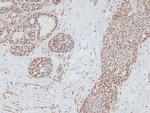 Phospho-DNA-PK (Thr2609) Antibody in Immunohistochemistry (Paraffin) (IHC (P))