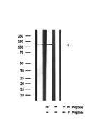 Phospho-c-Cbl (Tyr731) Antibody in Western Blot (WB)