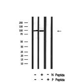 Phospho-INSR (Tyr999) Polyclonal Antibody
