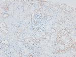 Phospho-IRAK1 (Thr387) Antibody in Immunohistochemistry (Paraffin) (IHC (P))