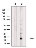 Phospho-MYL9 (Thr19, Ser20) Polyclonal Antibody