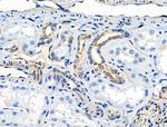 Phospho-NFATC2 (Ser326) Polyclonal Antibody