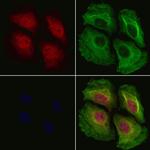 Phospho-NFkB p105 (Ser923) Polyclonal Antibody