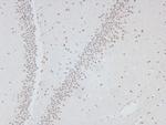 Phospho-PDGFRB (Tyr1009) Antibody in Immunohistochemistry (Paraffin) (IHC (P))