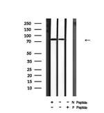 Phospho-CD31 (Tyr690) Antibody in Western Blot (WB)