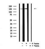 Phospho-PLCG2 (Tyr759) Polyclonal Antibody
