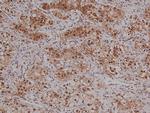 Phospho-VAV1 (Tyr160) Polyclonal Antibody
