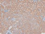 Phospho-HSL (Ser660) Polyclonal Antibody