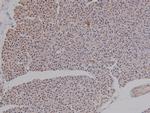 Phospho-AMPK beta-1 (Ser181) Antibody in Immunohistochemistry (Paraffin) (IHC (P))