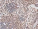 Phospho-MAX (Ser11) Antibody in Immunohistochemistry (Paraffin) (IHC (P))