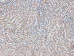 Phospho-ErbB2 (HER-2) (Thr686) Antibody in Immunohistochemistry (Paraffin) (IHC (P))