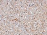 Phospho-ErbB2 (HER-2) (Thr686) Antibody in Immunohistochemistry (Paraffin) (IHC (P))