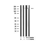 Phospho-ErbB2 (HER-2) (Tyr1139) Polyclonal Antibody
