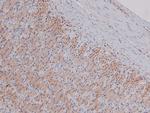 Phospho-PDGFRA (Tyr762) Polyclonal Antibody