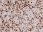 Phospho-RET (Tyr1096) Antibody in Immunohistochemistry (Paraffin) (IHC (P))
