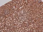 Phospho-RET (Tyr1096) Polyclonal Antibody