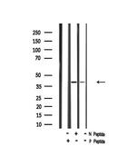 Phospho-GNAZ (Ser16) Polyclonal Antibody