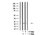 Phospho-HAND1 (Ser98) Polyclonal Antibody