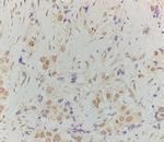 Phospho-HSF1 (Ser307) Antibody in Immunohistochemistry (Paraffin) (IHC (P))