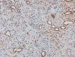 Phospho-ITK (Tyr512) Antibody in Immunohistochemistry (Paraffin) (IHC (P))