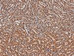 Phospho-ITK (Tyr512) Polyclonal Antibody