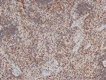 Phospho-ITK (Tyr512) Antibody in Immunohistochemistry (Paraffin) (IHC (P))