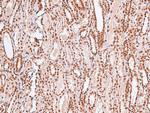 Phospho-MARK Pan (Thr215) Polyclonal Antibody