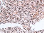 Phospho-MLK3 (Thr277, Ser281) Polyclonal Antibody