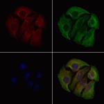 Phospho-Catenin alpha-1 (Ser641) Polyclonal Antibody