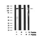 Phospho-eNOS (Ser1179) Antibody in Western Blot (WB)