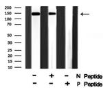 Phospho-TOP2A (Ser1213) Antibody in Western Blot (WB)