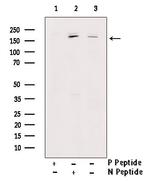 Phospho-TOP2A (Ser1213) Polyclonal Antibody
