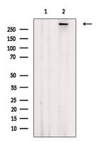 Phospho-ATM (Ser367) Polyclonal Antibody