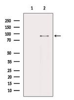 Phospho-beta Catenin (Tyr142) Antibody in Western Blot (WB)