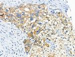 Phospho-beta Catenin (Ser675) Polyclonal Antibody