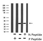 Phospho-Caveolin 2 (Ser23) Antibody in Western Blot (WB)