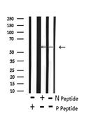 Phospho-CDC25A (Ser82) Polyclonal Antibody