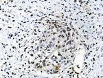 Phospho-CREB (Ser111) Polyclonal Antibody