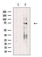 Phospho-Estrogen Receptor alpha (Thr311) Antibody in Western Blot (WB)