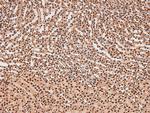 Phospho-FAK (Tyr577) Polyclonal Antibody