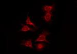 Phospho-FOXO4 (Thr455) Antibody in Immunocytochemistry (ICC/IF)
