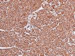 Phospho-FOXO4 (Thr455) Antibody in Immunohistochemistry (Paraffin) (IHC (P))