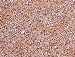 Phospho-FOXO4 (Thr455) Antibody in Immunohistochemistry (Paraffin) (IHC (P))