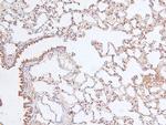 Phospho-FOXO4 (Thr455) Antibody in Immunohistochemistry (Paraffin) (IHC (P))