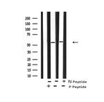 Phospho-FOXO4 (Thr455) Antibody in Western Blot (WB)