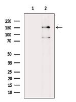 Phospho-Met (Ser985) Polyclonal Antibody